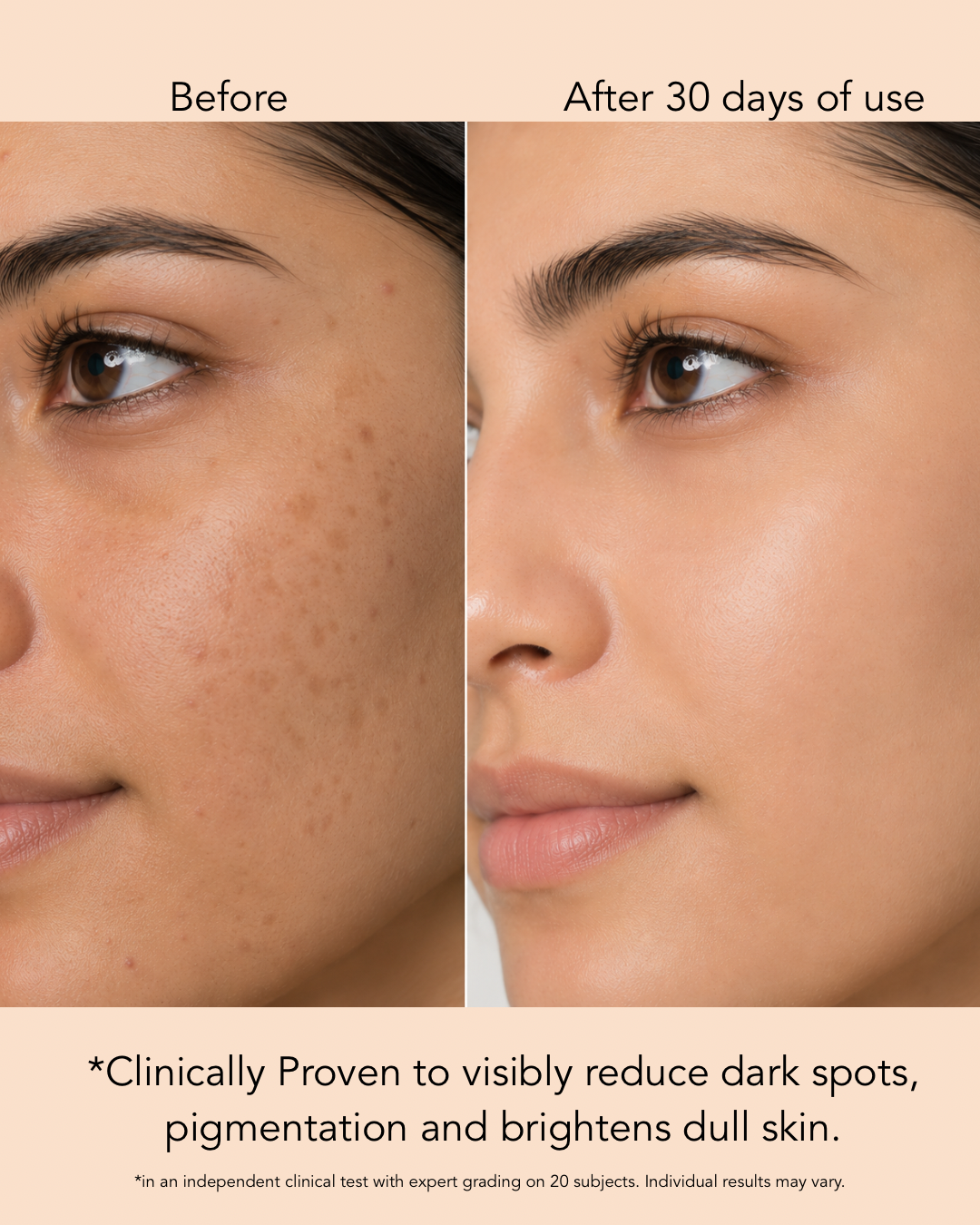 Tranexamic Acid + Niacinamide Serum