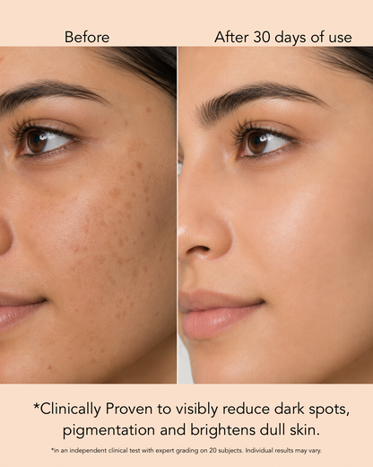 Tranexamic Acid + Niacinamide Serum